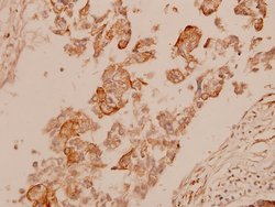 Invitrogen Cytokeratin 15 Polyclonal Antibody 100 &mu;L; Unconjugated:Antibodies,