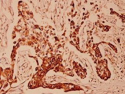 Invitrogen Cytokeratin 18 Polyclonal Antibody 100 &mu;L; Unconjugated:Antibodies,
