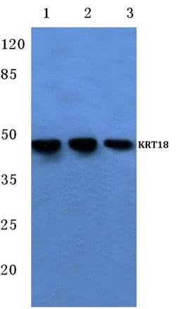 Invitrogen Cytokeratin 18 Polyclonal Antibody 100 &mu;L; Unconjugated:Antibodies,