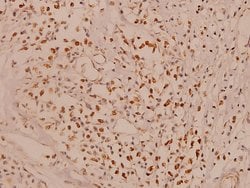 Invitrogen MCL-1 Polyclonal Antibody 100 &mu;L; Unconjugated:Antikroppar