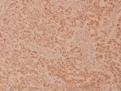 Invitrogen MEK2 Polyclonal Antibody 100 &mu;L; Unconjugated:Antibodies,