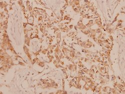 Invitrogen MEK3 Polyclonal Antibody 100 &mu;L; Unconjugated:Antibodies,