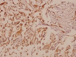 Invitrogen MMP16 Polyclonal Antibody 100 &mu;L; Unconjugated:Antibodies,