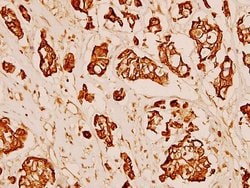 Invitrogen MMP3 Polyclonal Antibody 100 &mu;L; Unconjugated:Antibodies,