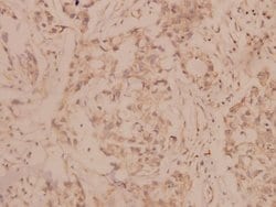Invitrogen MMP8 Polyclonal Antibody 100 &mu;L; Unconjugated:Antibodies,
