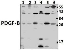 Invitrogen PDGF-B Polyclonal Antibody 100 &mu;L; Unconjugated:Antibodies,