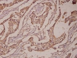 Invitrogen PSA Polyclonal Antibody 100 &mu;L; Unconjugated:Antibodies,