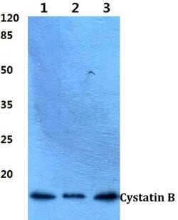 Invitrogen Cystatin B Polyclonal Antibody 100 &mu;L; Unconjugated:Antibodies,