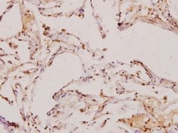 Invitrogen TGF beta-2 Polyclonal Antibody 100 &mu;L; Unconjugated:Antibodies,