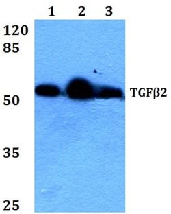 Invitrogen TGF beta-2 Polyclonal Antibody 100 &mu;L; Unconjugated:Antibodies,
