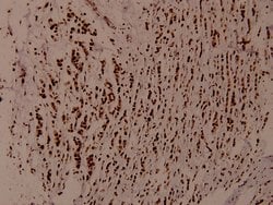 Invitrogen WNK1 Polyclonal Antibody 100 &mu;L; Unconjugated:Antibodies,