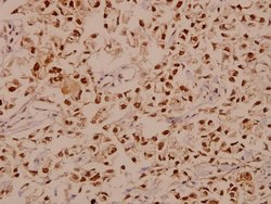 Invitrogen E2F1 Polyclonal Antibody 100 &mu;L; Unconjugated:Antibodies,