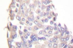 Invitrogen IKK beta Polyclonal Antibody 100 &mu;L; Unconjugated:Antibodies,
