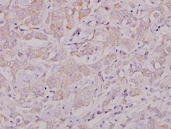 Invitrogen Lyn Polyclonal Antibody 100 &mu;L; Unconjugated:Antibodies,