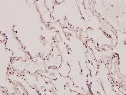 Invitrogen p130Cas Polyclonal Antibody 100 &mu;L; Unconjugated:Antibodies,