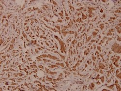 Invitrogen PLCG2 Polyclonal Antibody 100 &mu;L | Buy Online | Invitrogen&trade; | Fisher Scientific