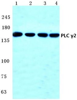 Invitrogen PLCG2 Polyclonal Antibody 100 &mu;L | Buy Online | Invitrogen&trade; | Fisher Scientific