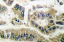 Invitrogen SGK1 Polyclonal Antibody 100 &mu;L; Unconjugated:Antibodies,