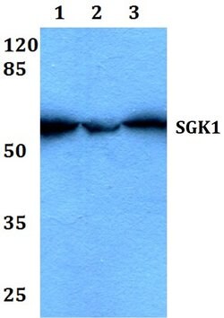 Invitrogen SGK1 Polyclonal Antibody 100 &mu;L; Unconjugated:Antibodies,