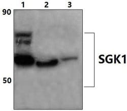 Invitrogen SGK1 Polyclonal Antibody 100 &mu;L; Unconjugated:Antibodies,