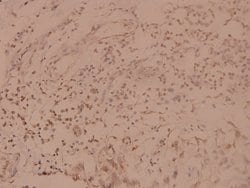 Invitrogen SHP-1 Polyclonal Antibody 100 &mu;L; Unconjugated:Antibodies,