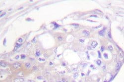 Invitrogen GRK2 Polyclonal Antibody 100 &mu;L; Unconjugated:Antibodies,