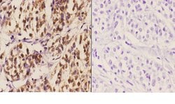 Invitrogen MDM2 Polyclonal Antibody 100 &mu;L; Unconjugated:Antibodies,