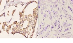 Invitrogen MDM2 Polyclonal Antibody 100 &mu;L; Unconjugated:Antibodies,