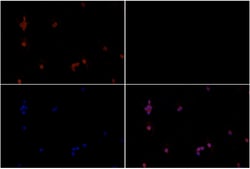RSK1 Polyclonal Antibody:Antibodies, Polyclonal