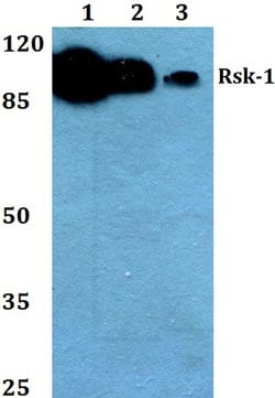 RSK1 Polyclonal Antibody:Antibodies, Polyclonal