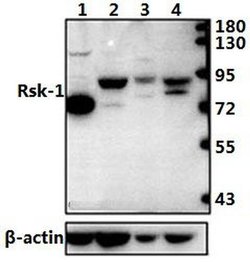 RSK1 Polyclonal Antibody:Antibodies, Polyclonal