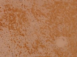 Invitrogen RSK1 Polyclonal Antibody 100 &mu;L; Unconjugated:Antibodies,