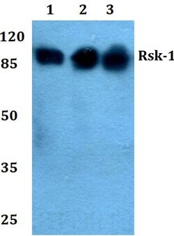 Invitrogen RSK1 Polyclonal Antibody 100 &mu;L; Unconjugated:Antibodies,