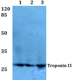 Invitrogen Cardiac Troponin I Polyclonal Antibody 100 &mu;L; Unconjugated:Antibodies,