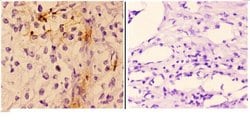 Invitrogen Cardiac Troponin I Polyclonal Antibody 100 &mu;L; Unconjugated:Antibodies,
