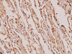 Invitrogen&trade;&nbsp;TIMP4 Polyclonal Antibody
