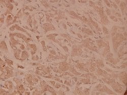 Invitrogen TNFR1 Polyclonal Antibody 100 &mu;L; Unconjugated:Antibodies,