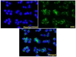 Invitrogen Tyrosinase Polyclonal Antibody 100 &mu;L; Unconjugated:Antibodies,