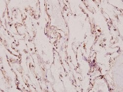 Invitrogen XRCC1 Polyclonal Antibody 100 &mu;L | Buy Online | Invitrogen&trade; | Fisher Scientific