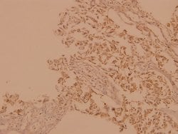 Invitrogen A-Raf Polyclonal Antibody 100 &mu;L; Unconjugated:Antibodies,