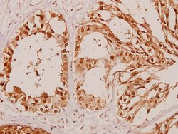Invitrogen beta Arrestin 1 Polyclonal Antibody 100 &mu;L; Unconjugated:Antibodies,