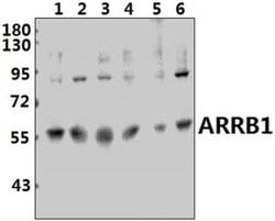 Invitrogen beta Arrestin 1 Polyclonal Antibody 100 &mu;L; Unconjugated:Antibodies,
