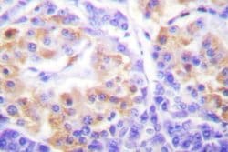 Invitrogen Collagen III Polyclonal Antibody 100 &mu;L; Unconjugated:Antibodies,
