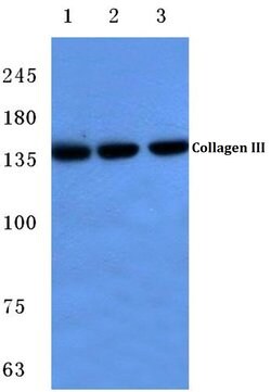 Invitrogen Collagen III Polyclonal Antibody 100 &mu;L; Unconjugated:Antibodies,