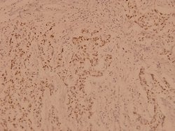 Invitrogen PBK Polyclonal Antibody 100 &mu;L; Unconjugated:Antibodies,