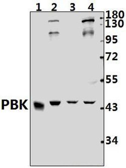 Invitrogen PBK Polyclonal Antibody 100 &mu;L; Unconjugated:Antibodies,
