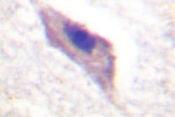 PKC mu Polyclonal Antibody:Antibodies, Polyclonal