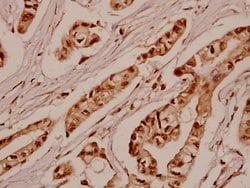 Invitrogen SGK1 Polyclonal Antibody 100 &mu;L; Unconjugated:Antibodies,