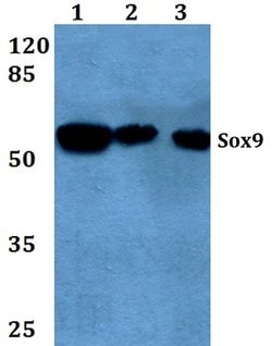 Invitrogen SOX9 Polyclonal Antibody 100 &mu;L; Unconjugated:Antibodies,