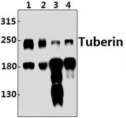 Invitrogen TSC2 Polyclonal Antibody 100 &mu;L; Unconjugated:Antibodies,